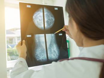 Mammographie: Vorsorge kann Leben retten